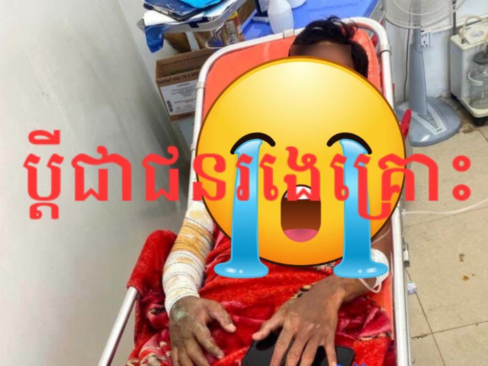 តាមទាន់ប្តីនៅជាមួយស្រីស្នេហ៍ក្នុងផ្ទះសំណាក់ ប្រពន្ធយកសាំងចាក់ដុត បណ្តាលឱ្យរងរបួសធ្ងន់ ២នាក់